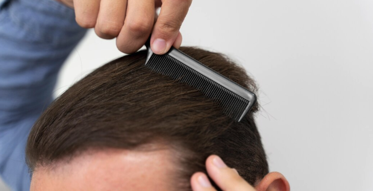 핀파시아 라무몰 탈모에 대한 획기적인 솔루션